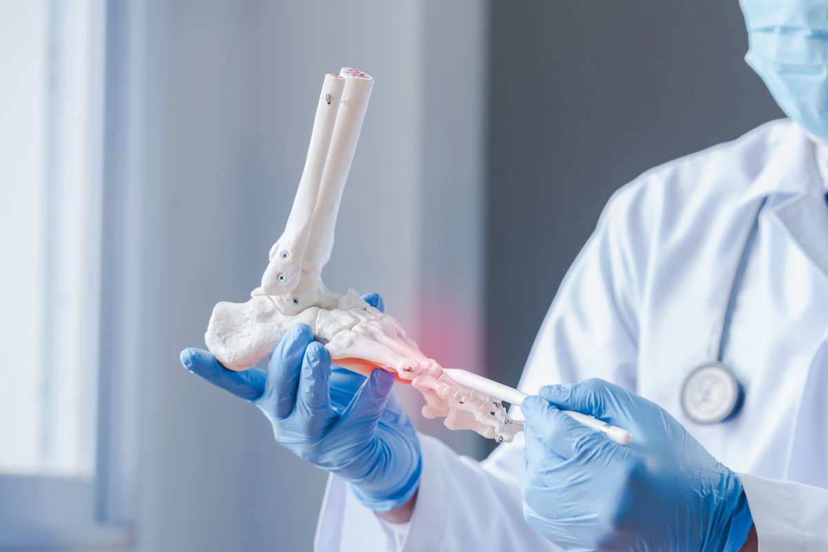 An orthopedic doctor looking at a fake ankle bone Male doctors orthopedic wears medical masks and medical gloves To analyze the causes of ankle degeneration in the office at the hospital